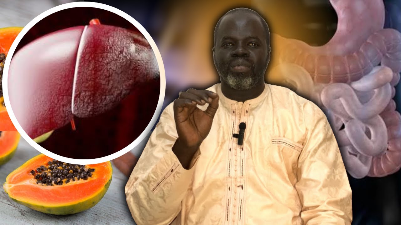 Cirrhose #2 - ( Préventions et Solutions ) - Pr Ousmane Ndiaye - SAMA XALAAT TV