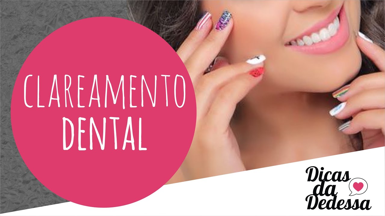 Clareamento Dental - DICAS DA DEDESSA