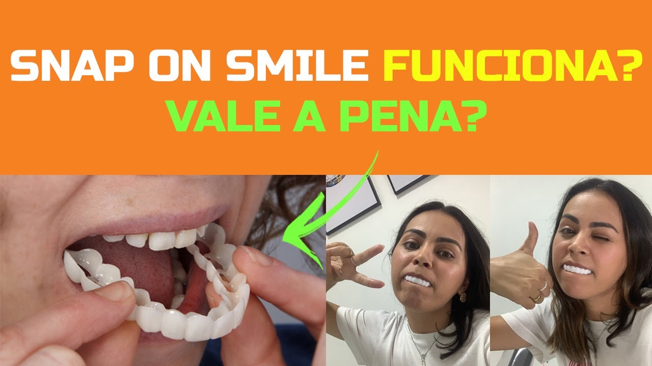 COMPREI UM SNAP ON SMILE! Será que fiquei com sorriso de Hollywood?