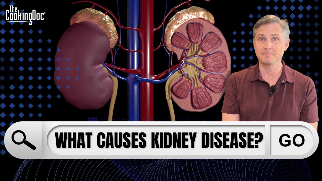 What Causes Kidney Disease? | The Cooking Doc&reg;