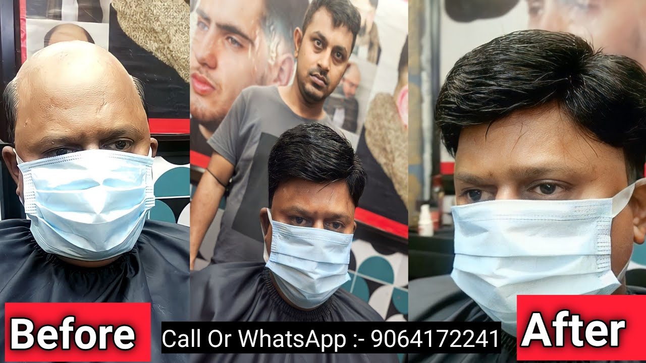 Miraj Hair Patch | Miraj Hair Patch Review | Call Or WhatsApp:- 9064172241 | Non Surgical Hair Patch