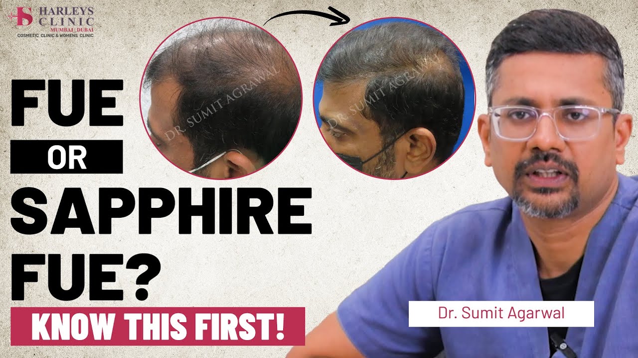 FUE vs Advanced Sapphire FUE: Which Hair Transplant Technique Is Better in 2025? | Dr Sumit Agarwal
