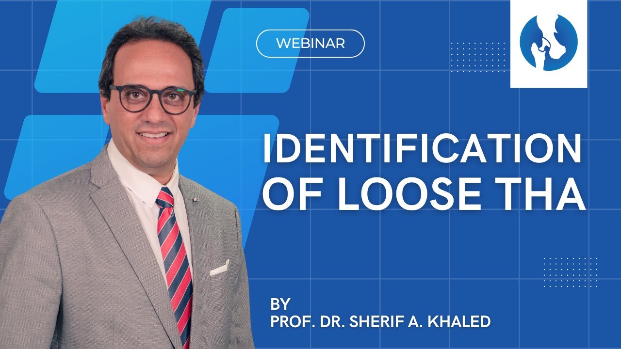 Identification of Loose THA (Prof. Dr. Sherif A. Khaled)