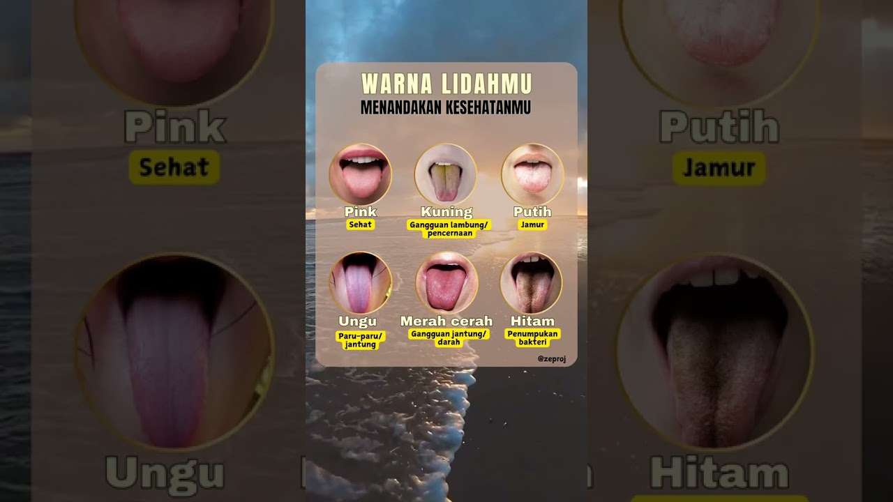Mengenali gangguan kesehatan badan melalui warna lidah #infokesehatan #lidah #asamlambung #kesehatan