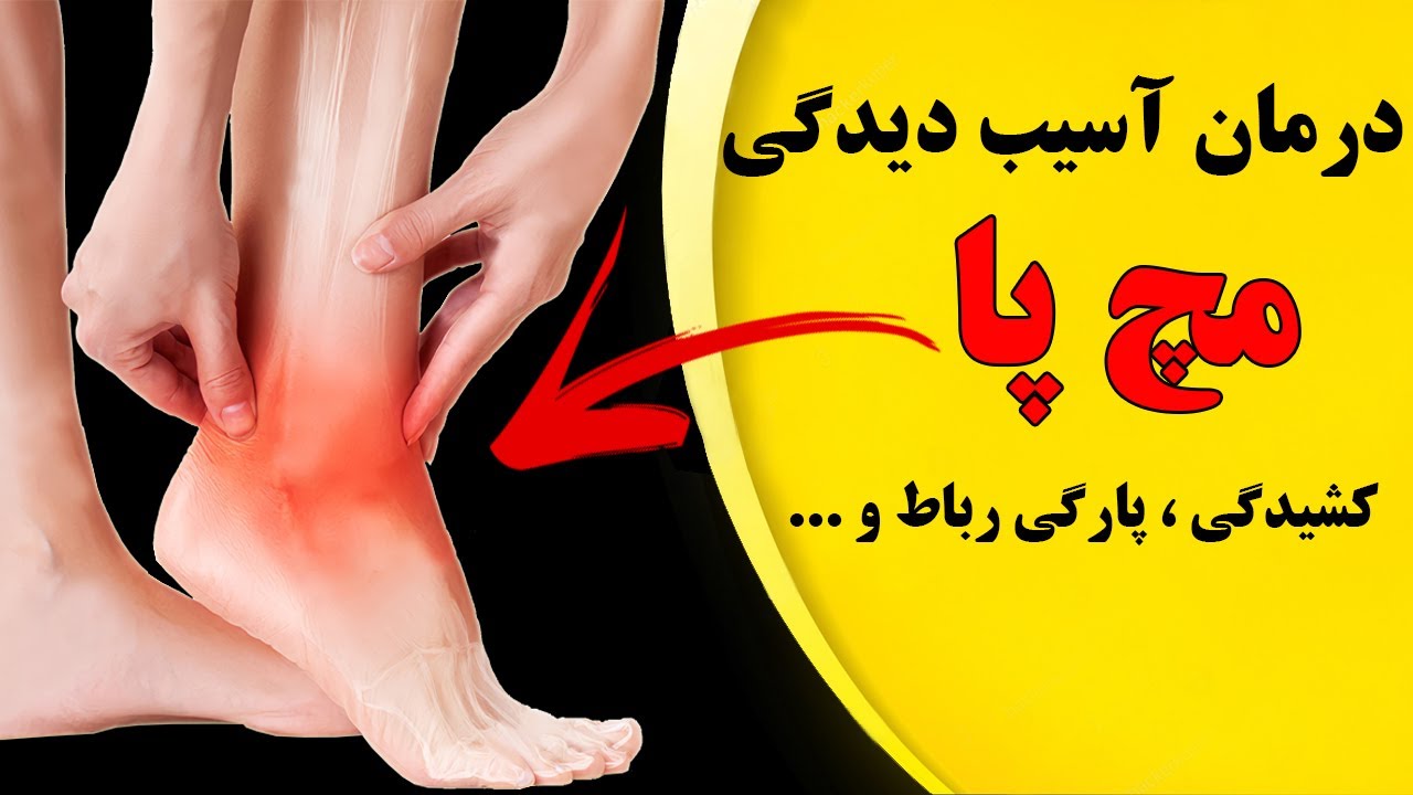 چگونه مچ درد را در منزل درمان کنیم؟ آموزش حرکات اصلاحی رفع آسیب دیدگی مچ پا ( کشیدگی و پارگی رباط )