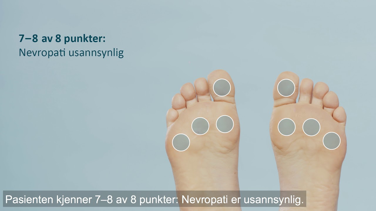 Diabetes: Fot og nevropati (3/7)