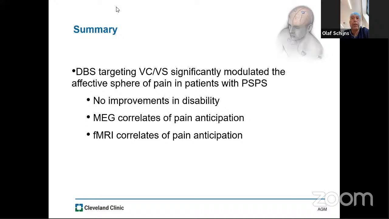 THE EANS WEBINAR: BRAIN SURGERY FOR PAIN