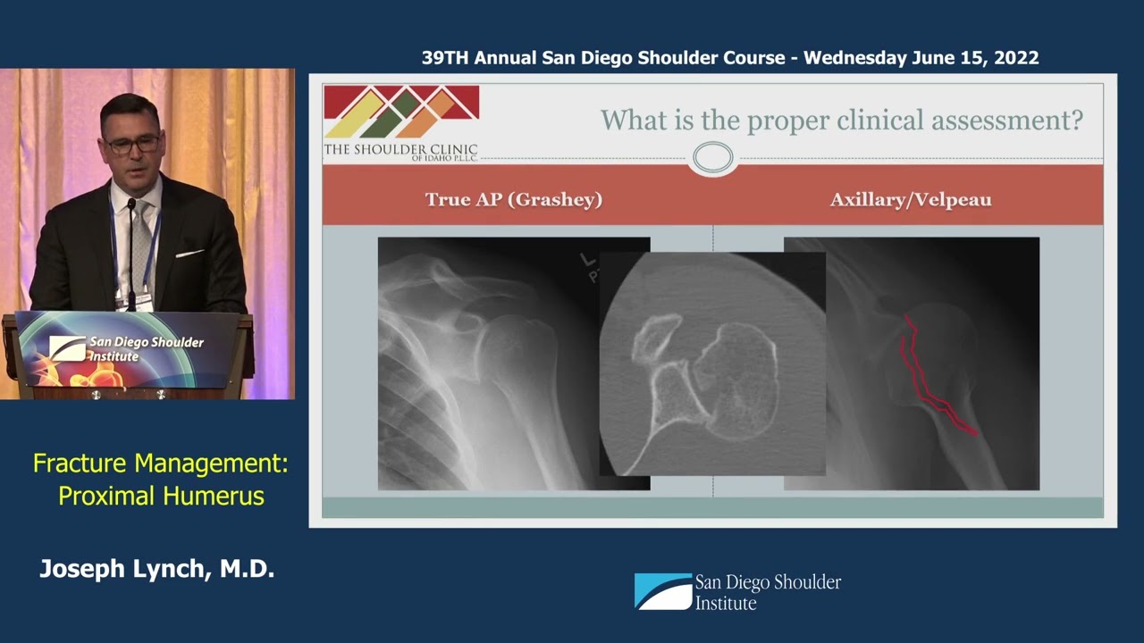 Fracture Management: Proximal Humerus | Joseph Lynch, MD | SDSI Shoulder Course CME
