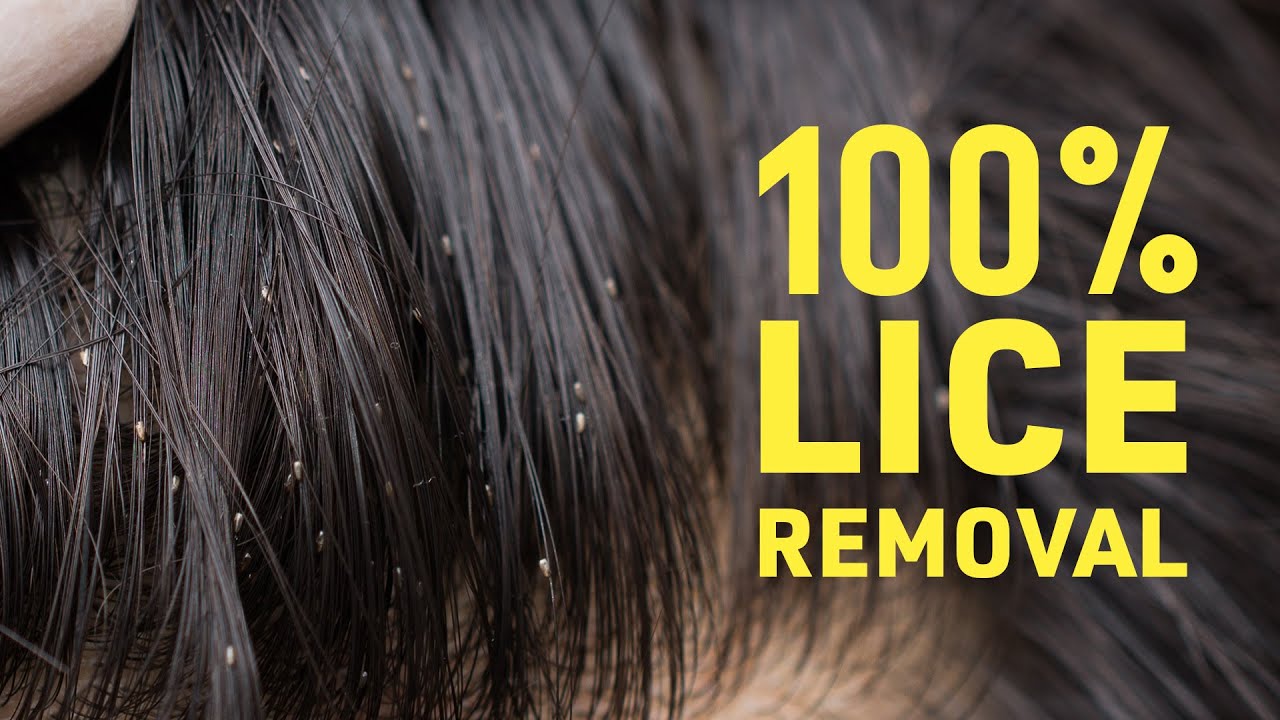 Get Rid Of Lice COMPLETELY | Safe & Natural Home Remedies For Lice & Nits