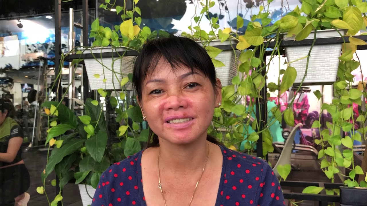 Bạch biến v&agrave; 7 ng&agrave;y điều trị c&ugrave;ng MR Phong | Điều trị bạch biến HemaCare