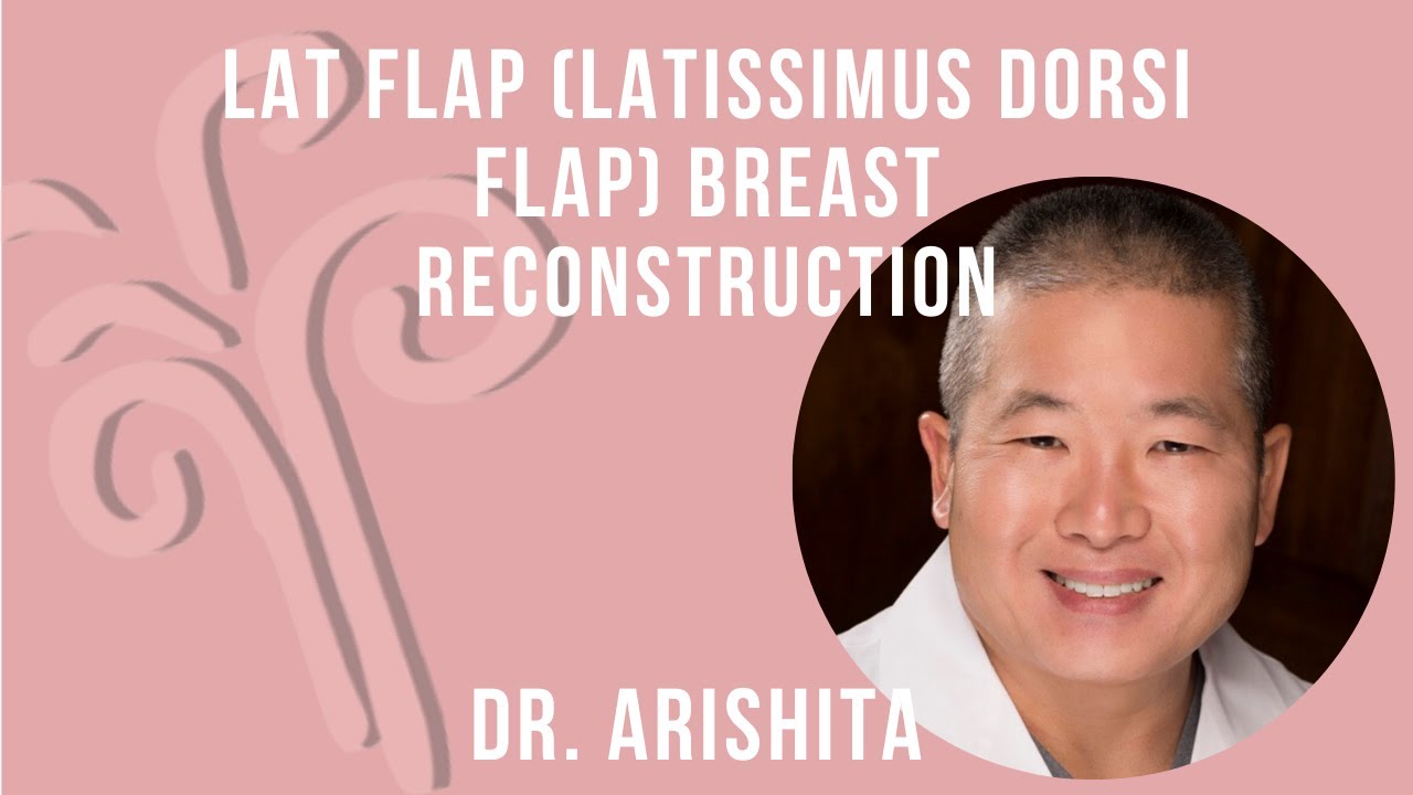 LAT Flap (Latissimus Dorsi Flap) Breast Reconstruction