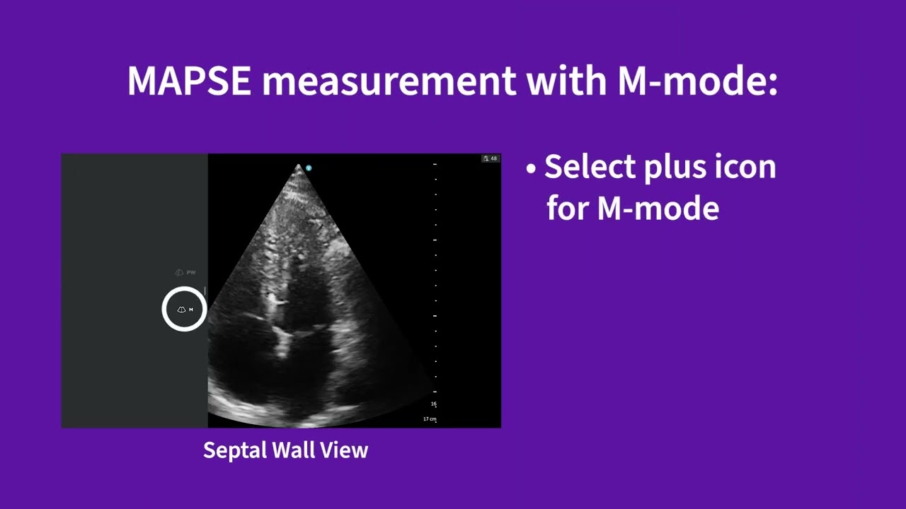 Vscan Air™ | Using presets for evaluations: cardiac function