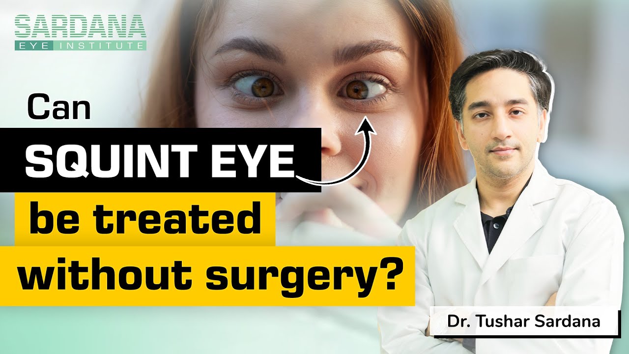 Squint Eye Treatment without Surgery | bhengapan kaise dur kare  | Dr. Tushar Sardana