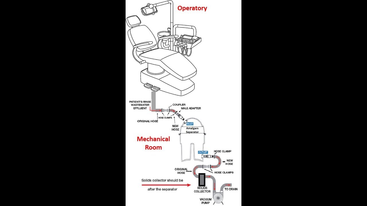 How do Amalgam Separators Work?