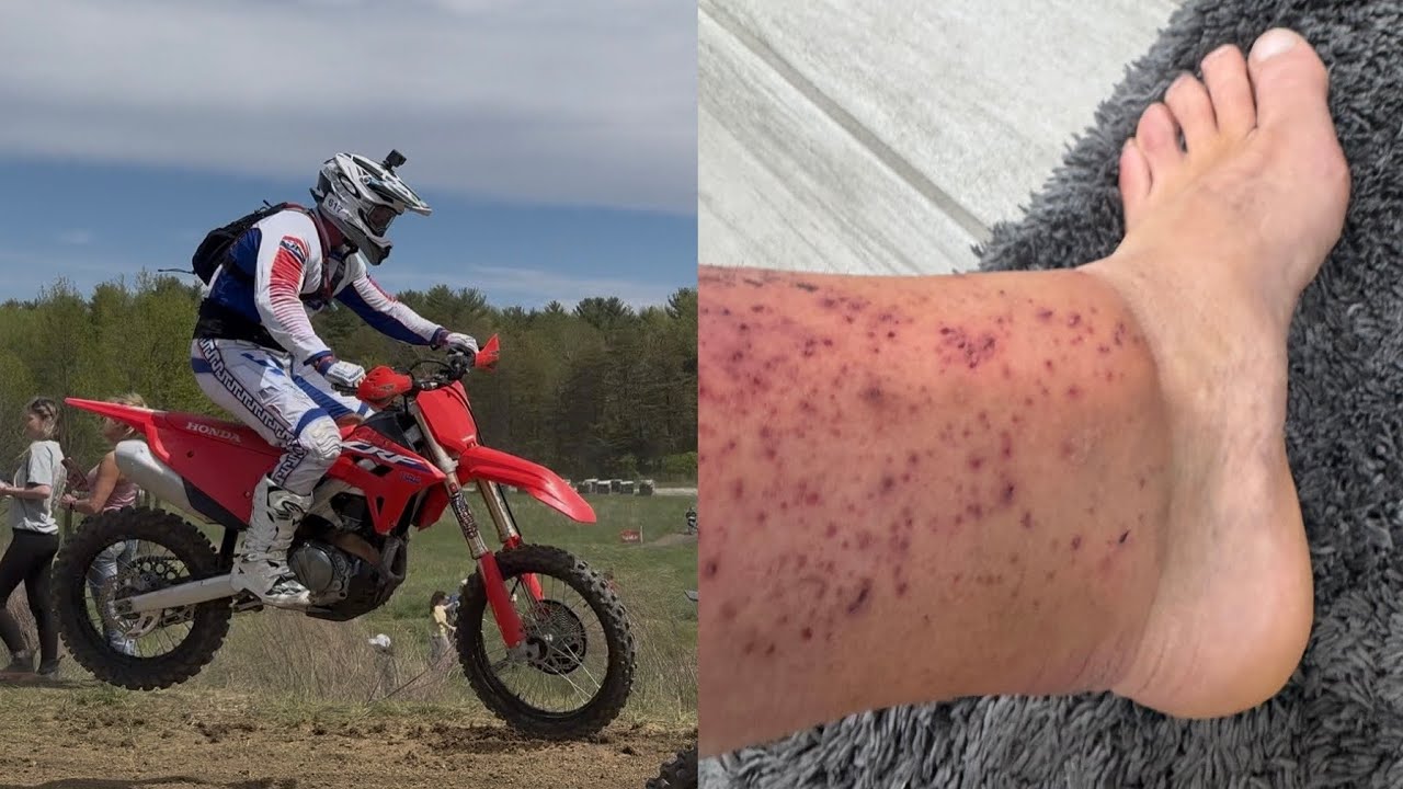 I Think My Shin Is Broke!!!                    (IXCR Round 2 Battle Under The Bridge ￼2025)