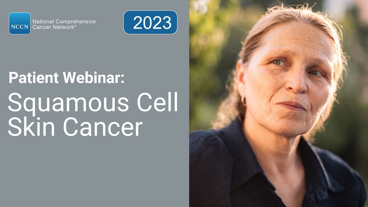 NCCN Patient Webinar: Squamous Cell Skin Cancer