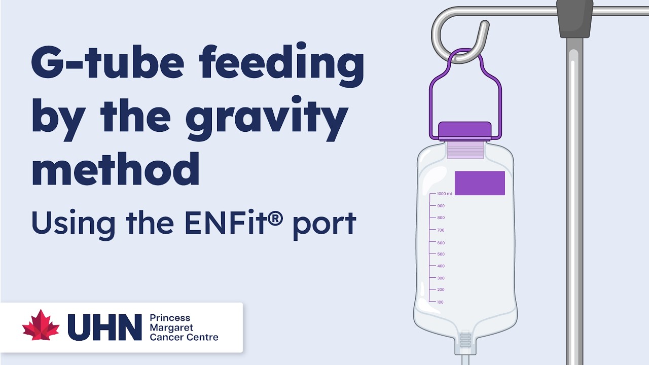 G-tube feeding by the gravity method – Using an ENFit port