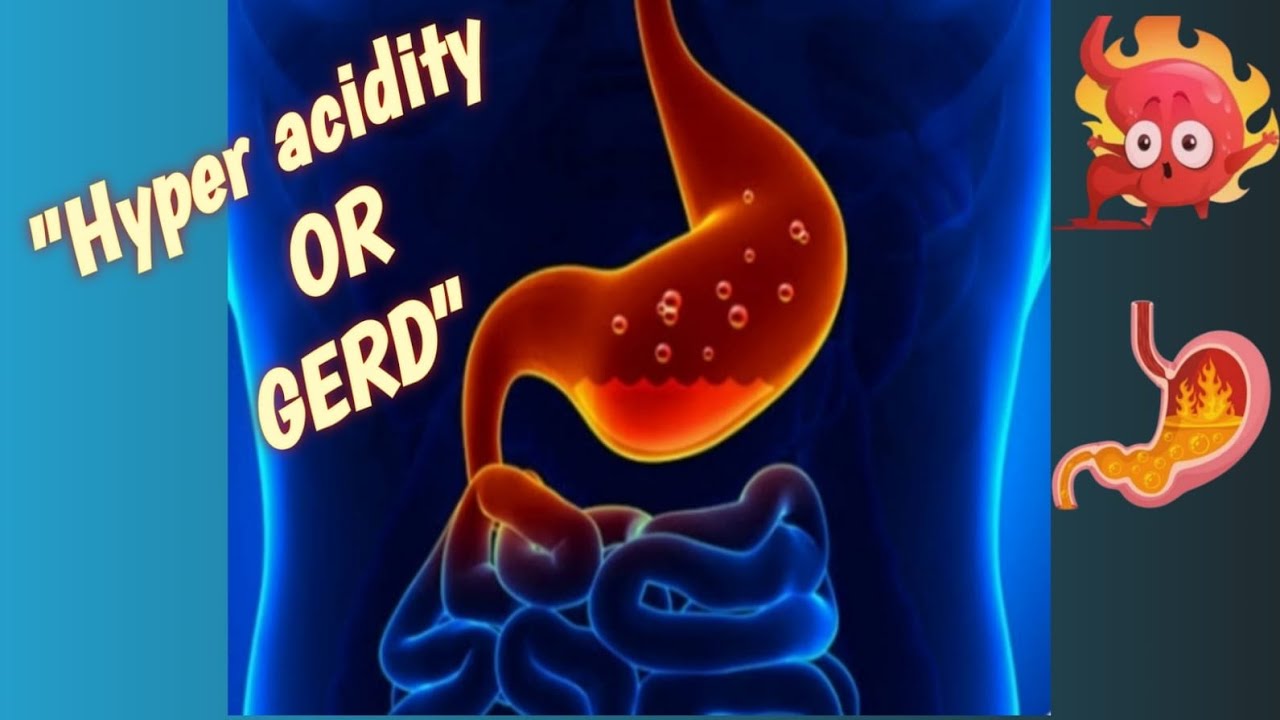 “Acidity or GERD