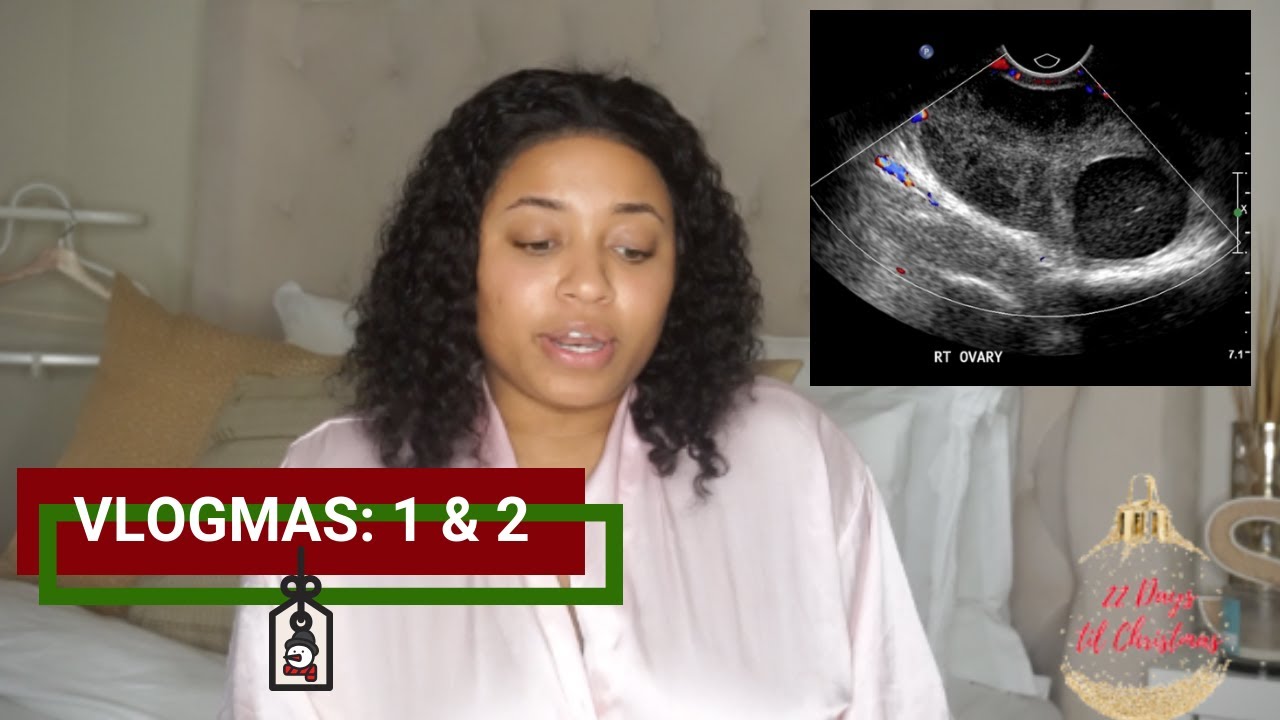 Vlogmas 1&2: My Ovarian Dermoid Cyst / Cancerous | 25 Days of Beauty
