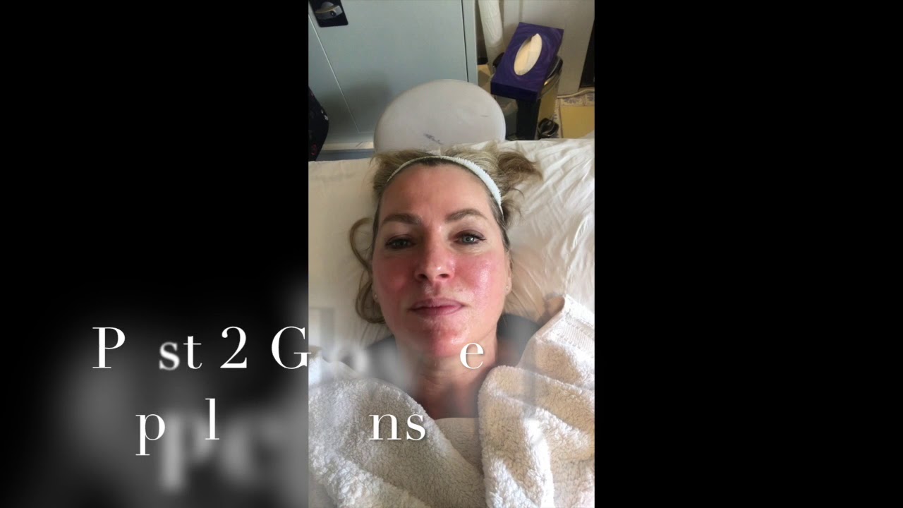 AlumierMD Glow Peel|Sandy Henshaw London Aesthetics