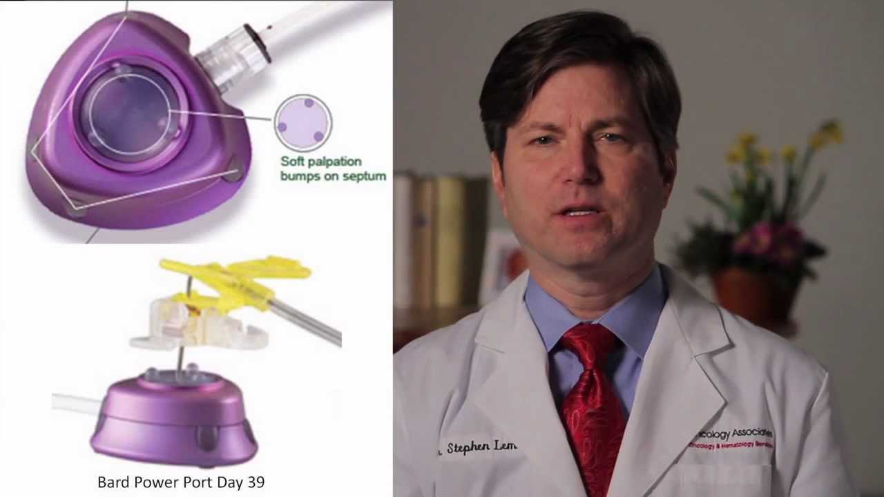 How a Portacath is used for Chemotherapy Treatment