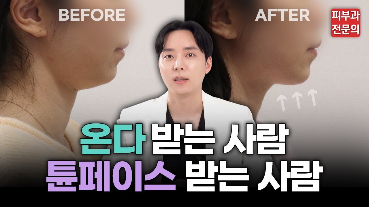 튠페이스 vs 온다 리프팅, 뭐가 다를까? ｜자세함 주의