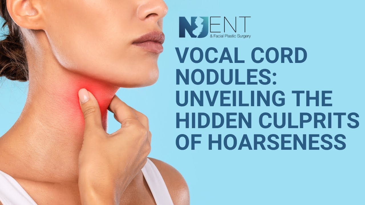 Vocal Cord Nodules - Unveiling the Hidden Culprits of Hoarseness