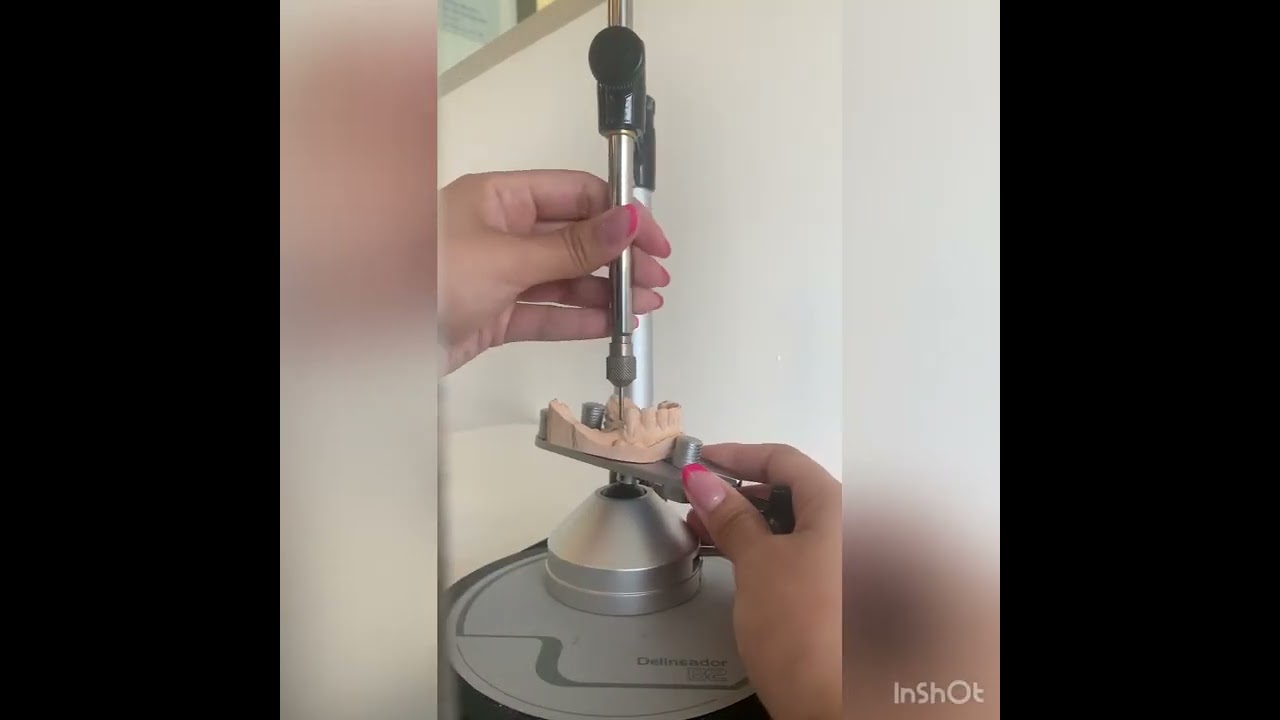 Video paralelometro clase 1