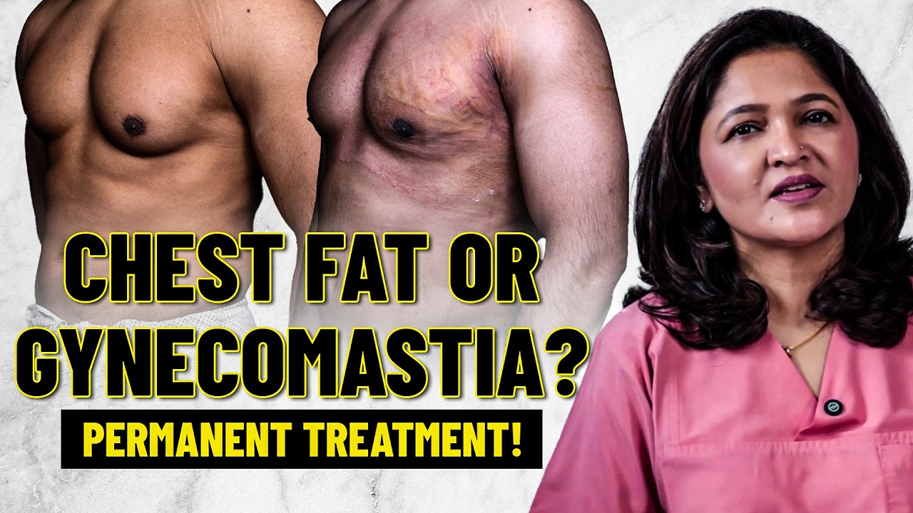 Gynecomastia vs Chest Contouring Surgery: असली अंतर क्या है? |Liposuction or Gland Removal Explained