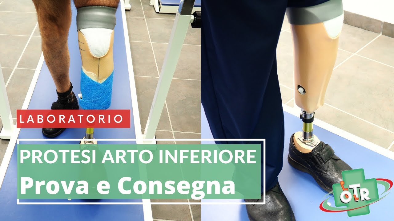 OTR Ortopedia - LABORATORIO - Ottobock - Protesi arto inferiore - Prova e Consegna