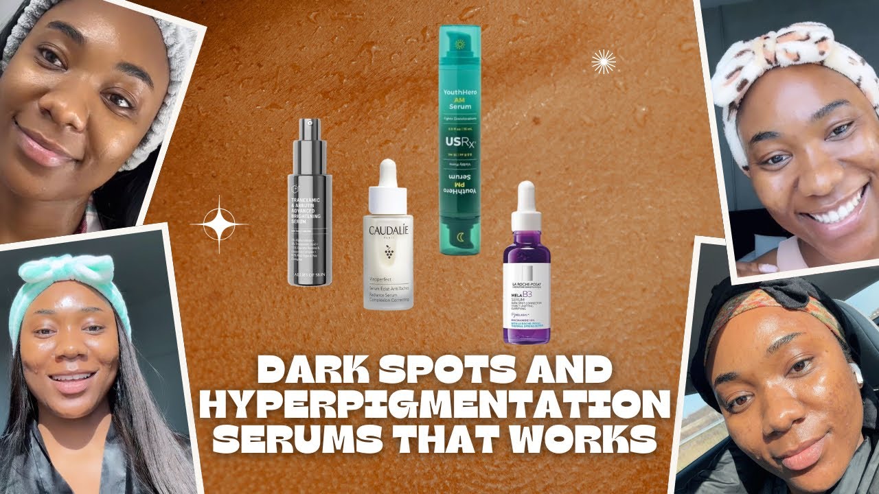 Use this serums if you want to get rid of hyperpigmentation and dark spots 