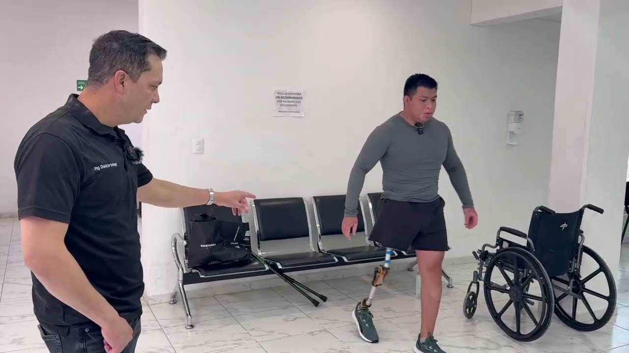 Muñón corto de 10 centímetros transfemoral #socketprostético #protesisdepierna #protesis