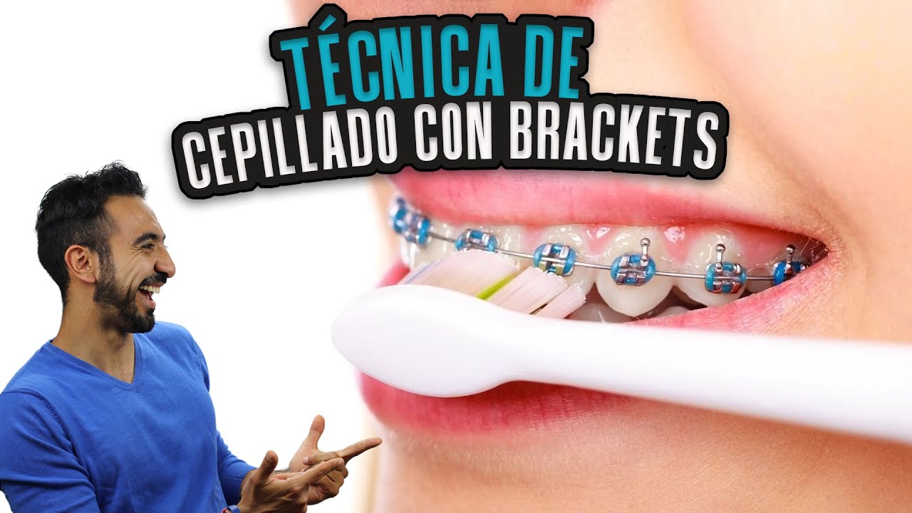 Cómo Cepillarse los Dientes CON BRACKETS. Técnica de Cepillado con Brakets. Tu dentista de confianza