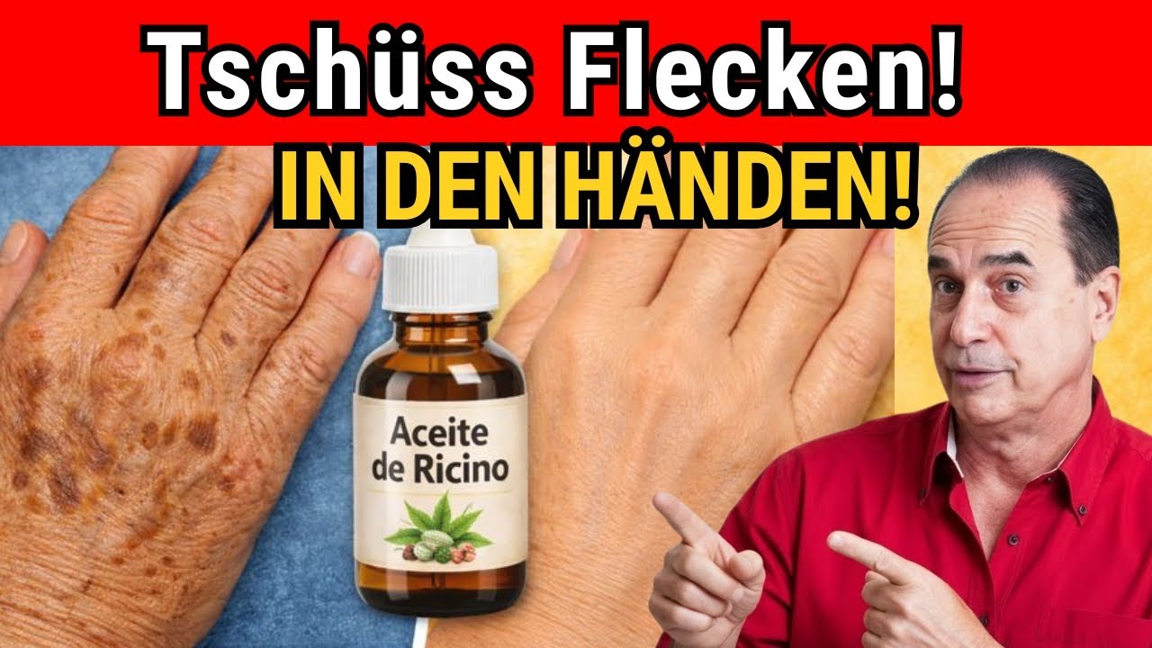 ZeitlosSchoen: Flecken Auf Händen & Gesicht Weg Ohne Laser Pflege-Routine