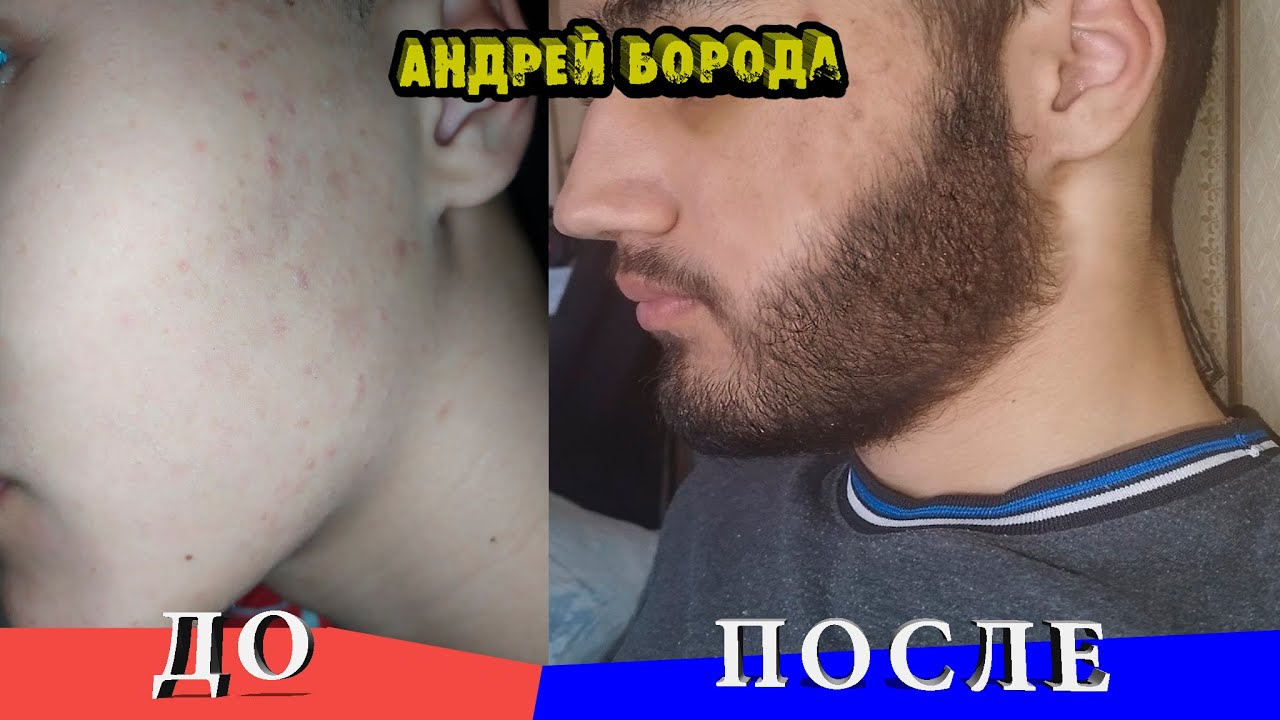 Запустил рост бороды / Мазал 1 год / Теперь его нельзя продавать на ВБ / ВЫПУСК №6 / Андрей Борода