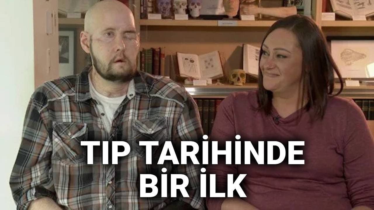 @NTV Tıp tarihinde bir ilk: Tam göz nakli yapıldı