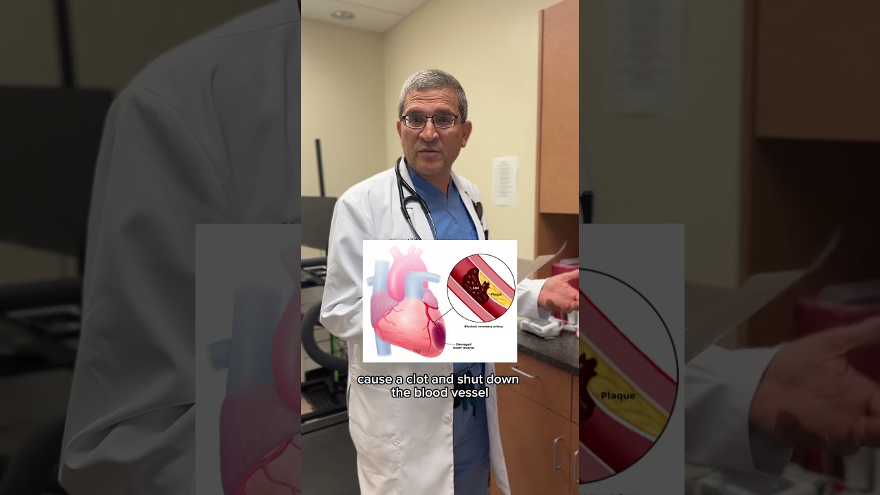 Can #stress cause a #heart attack? Cardiologist, Dr. Shabaneh explains! 🫀