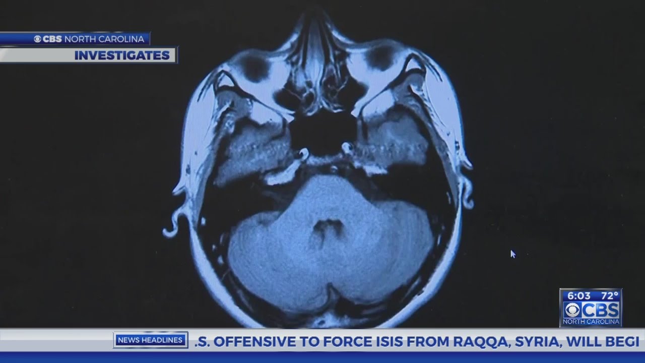VA fails to properly examine thousands of veterans