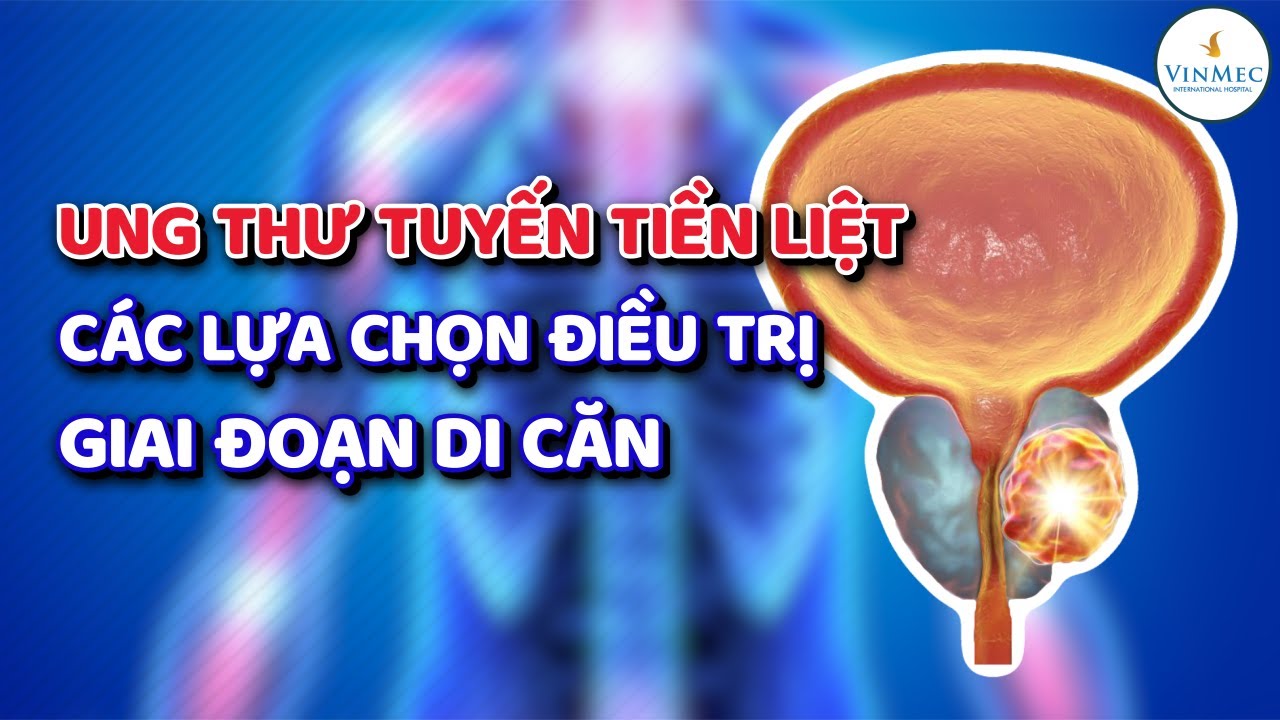 Ung thư tuyến tiền liệt &ndash; c&aacute;c lựa chọn điều trị giai đoạn di căn
