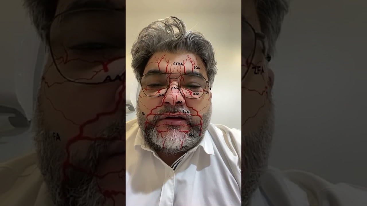 الاماكن الخطيره في حقن الفيلر