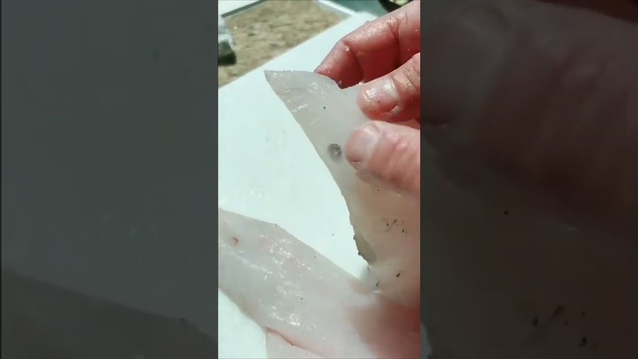 Parasites hidden in my food