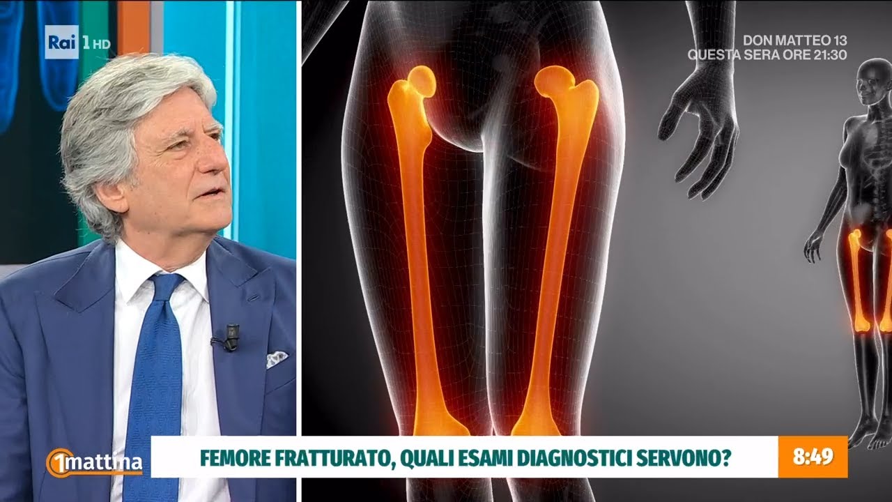 La frattura femore: può essere composta o scomposta - Unomattina 29/05/2025