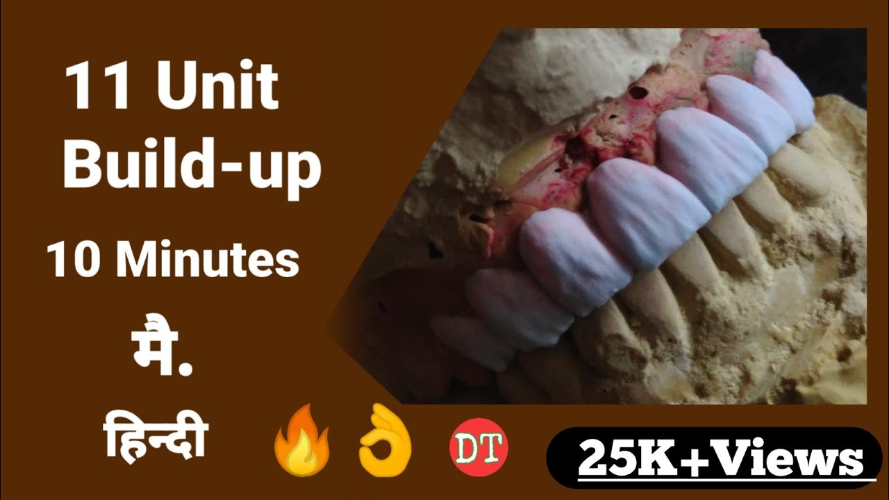 First Build up| Dental Technician| Ceramic Build-up| ceramic layering| my Build-up Technique| Dant