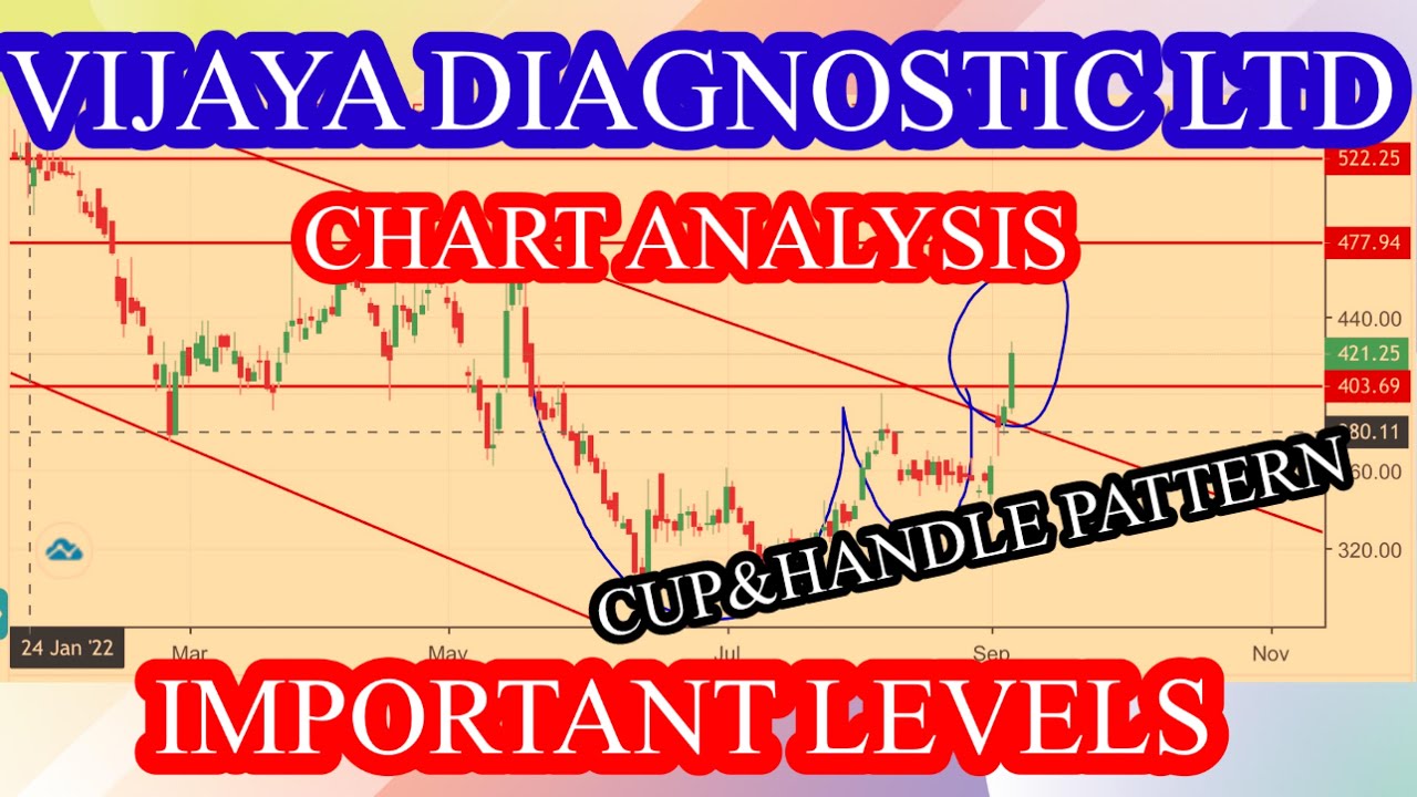 Vijaya diagnostic share latest news | Vijaya diagnostic share news today | Vijaya diagnostic centre