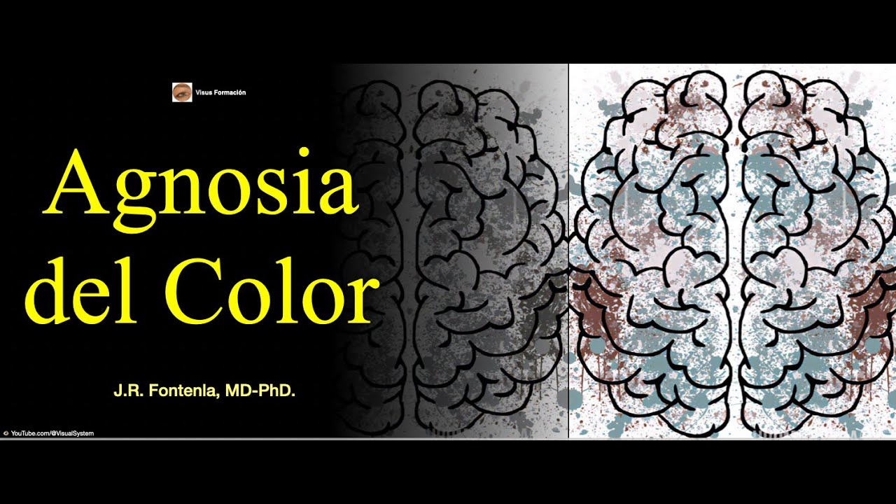 Agnosia del Color. Agnosia Visual.