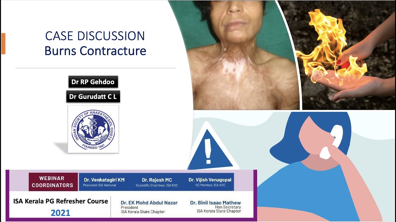 Burns Contracture Neck - Case Discussion | Kerala ISA PG Refresher Course 2021