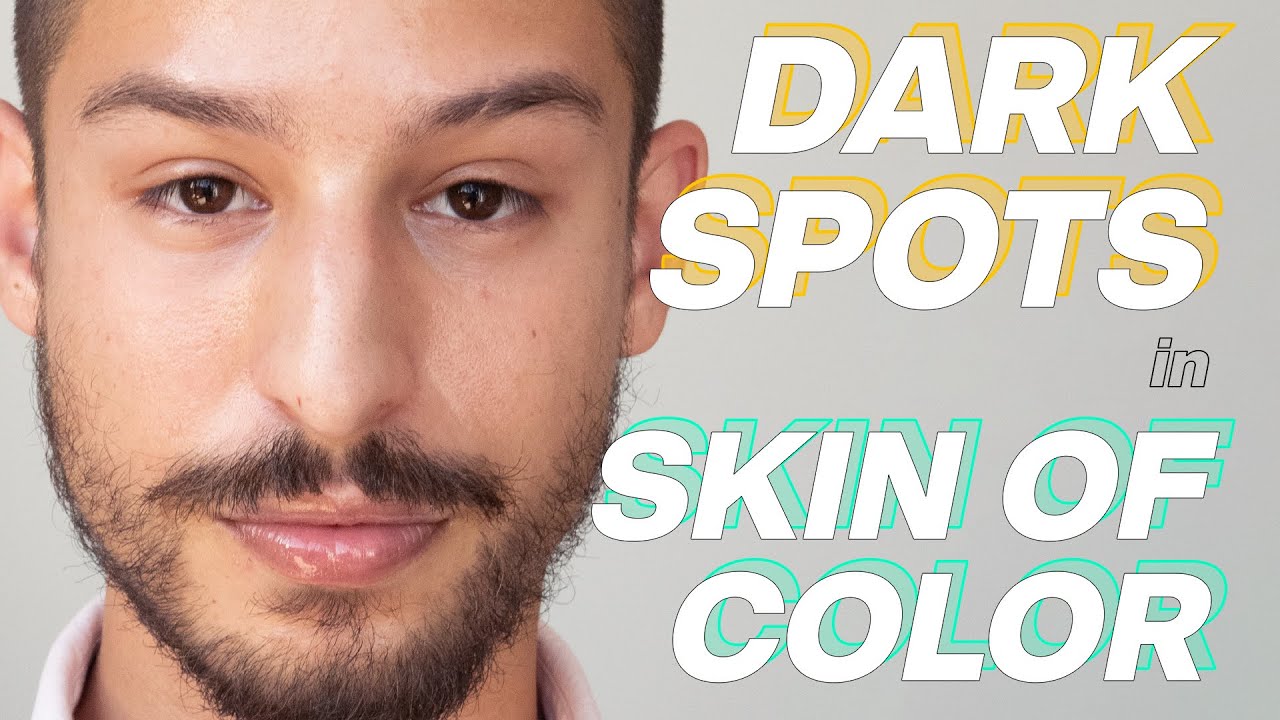 How To Fade/Prevent Dark Spots and Hyperpigmentation for Brown + Black Skin | Simplified