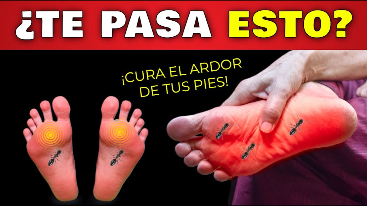 💥 &iexcl;ARDOR en los PIES! Causas de HORMIGUEO y DOLOR en PIES | As&iacute; SANAR&Aacute;S los NERVIOS DA&Ntilde;ADOS