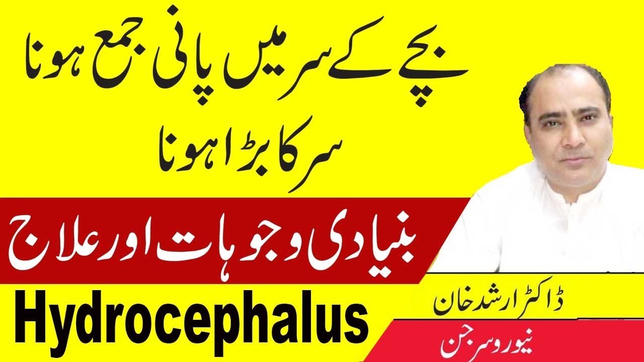 Hydrocephalus: Causes, Symptoms, Diagnosis & Treatment Explained In Urdu/Hindi