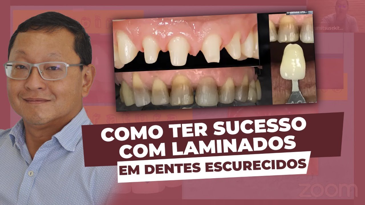 Sorrisos Naturais em Substratos Escuros